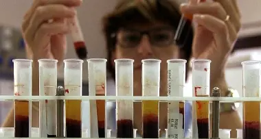 Trento: «Aids: un'epidemia nascosta»