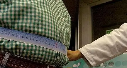 Da obesa ad anoressica, dietologo a processo