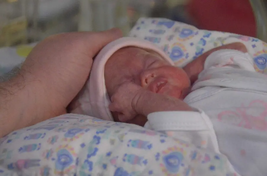 nascita bambino prematuro coppia inglese ospedale santa chiara neonatologia