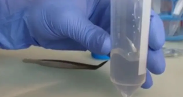 Paganella, due persone morte per legionella: la Procura apre un fascicolo