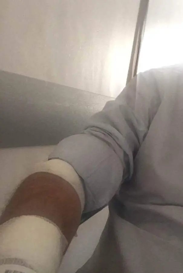 Dopo Mosaner anche Caproni in ospedale
