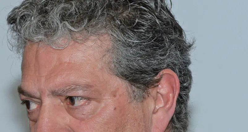 Vince il Patt: Bollettin si è dimessa