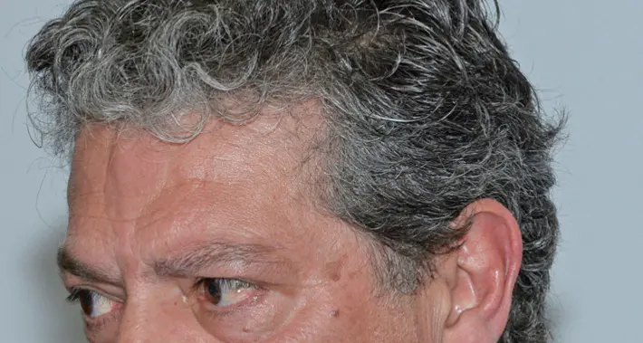 Polo scolastico del Rione, assegnati i lavori