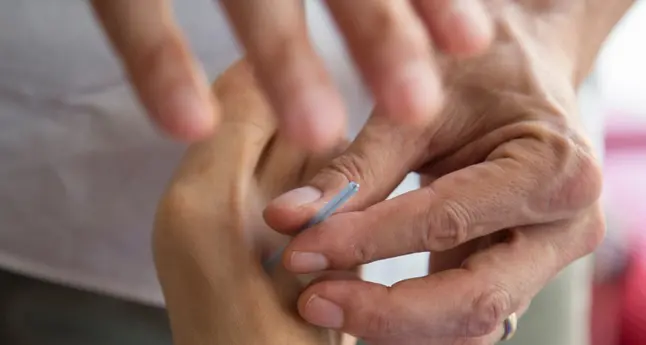 Alla Lilt sedute di agopuntura oncologica