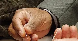 Anche a Cles sedute di agopuntura per pazienti oncologici