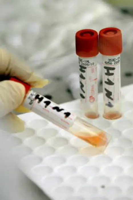 Coronavirus, spuntano i truffatori che \"spacciano\" test domiciliari