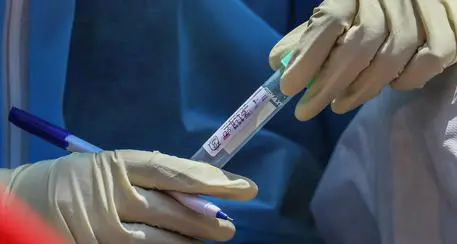 Coronavirus, \"test di immunità\" per tutti gli 8 mila residenti nei comuni \"zona rossa\"
