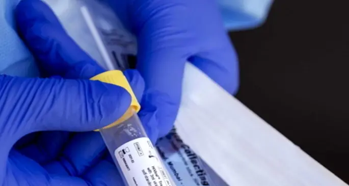 Test sierologico solo per chi lo vorrà