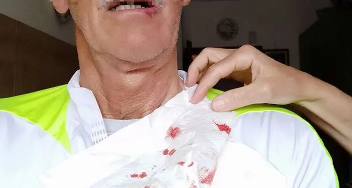 Trento, aggredito da un condomino mentre fa running a Gardolo