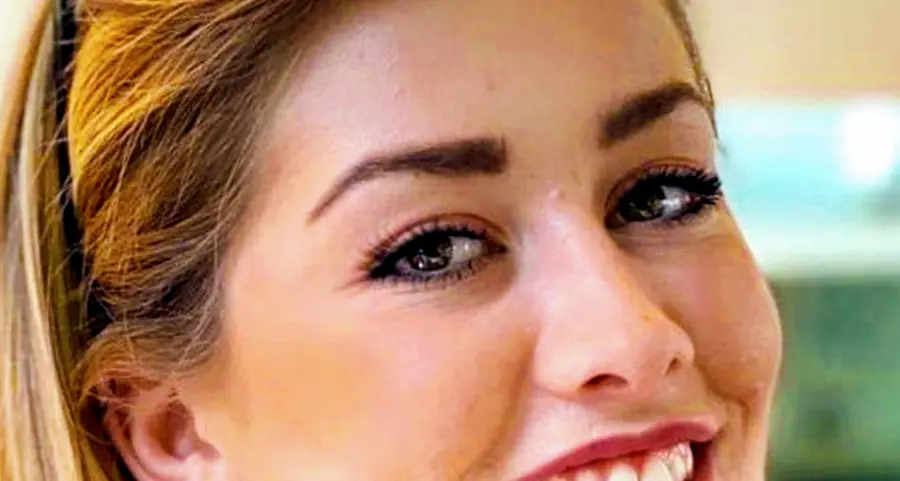 Il sorriso di Elosea si è spento a 25 anni
