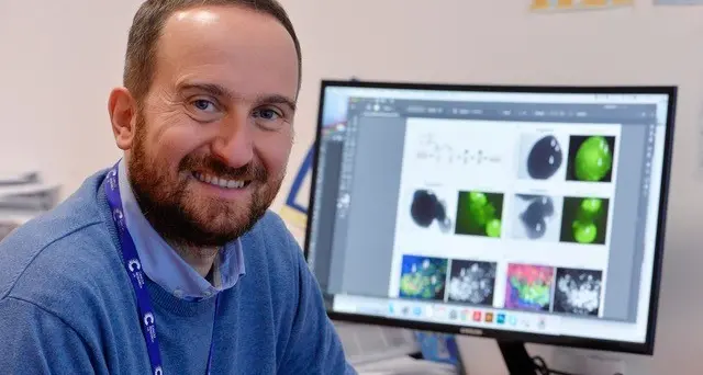 Tiberi, professore del Cibio di Trento: \"Creiamo cervelli artificiali per combattere i tumori cerebrali nei bambini\"