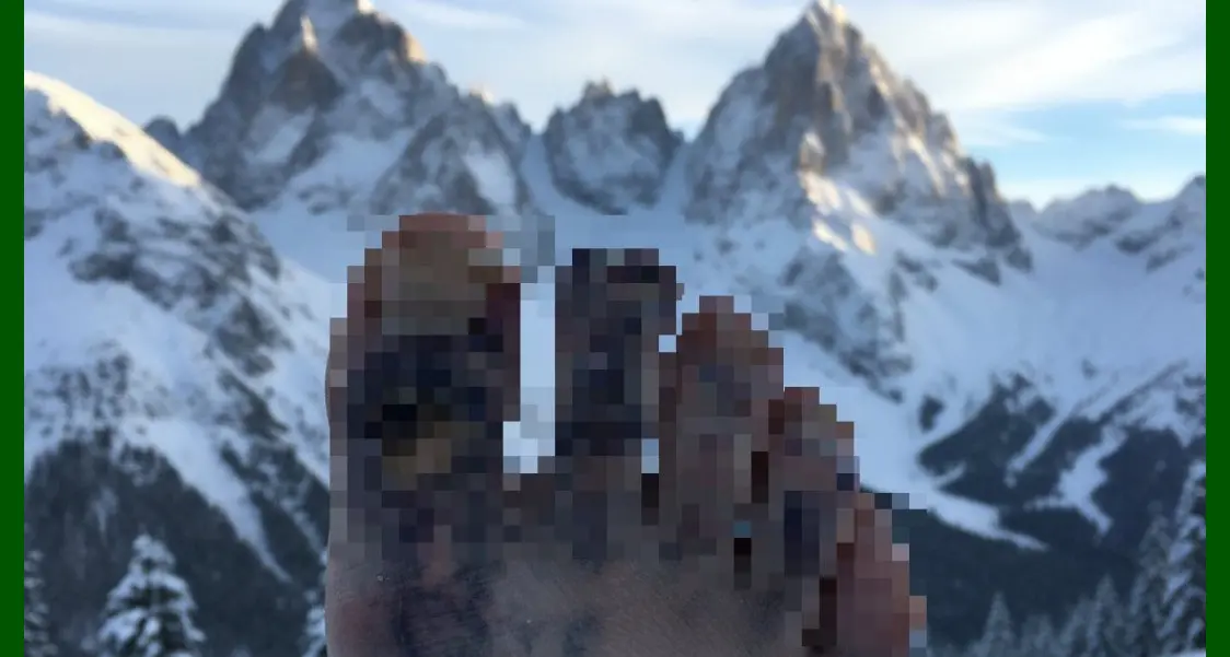 Un congelamento himalayano, ma sulle Dolomiti dietro casa