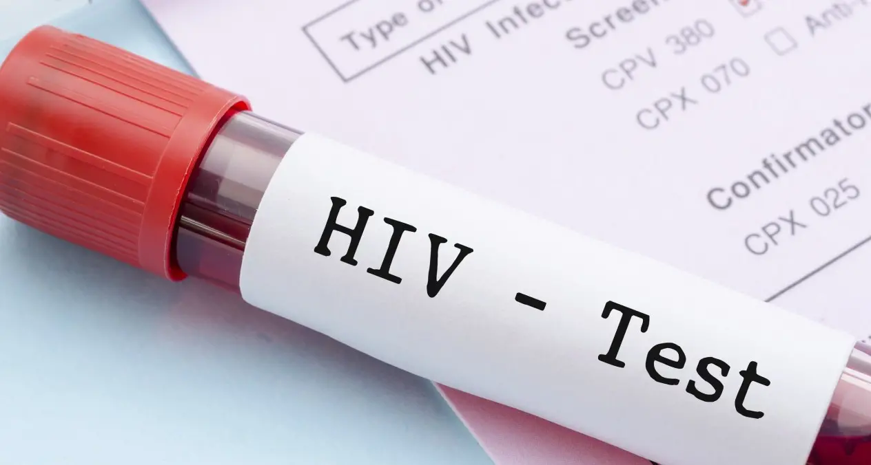 Test rapidi, gratuiti e anonimi per Hiv, sifilide e Aids